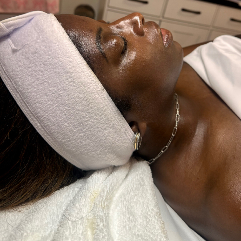 Lemon Honey Facial (Seasonal) at Sandra the Esti LLC in Downers Grove, IL