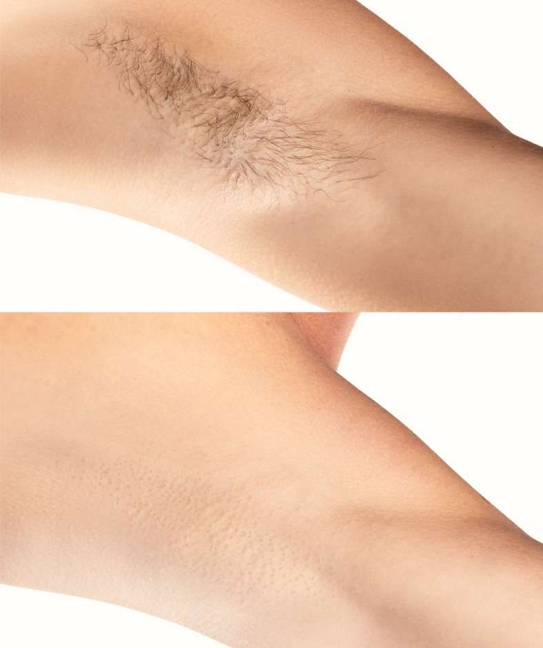 Underarm Wax