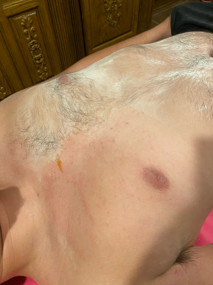 Full Chest/ Stomach