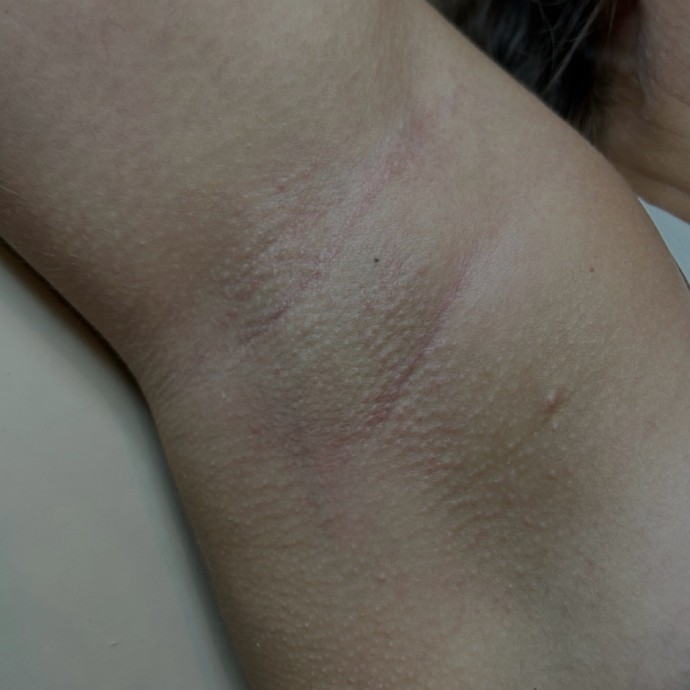 underarm wax at PureHavenEsthetics in Kearney, NE