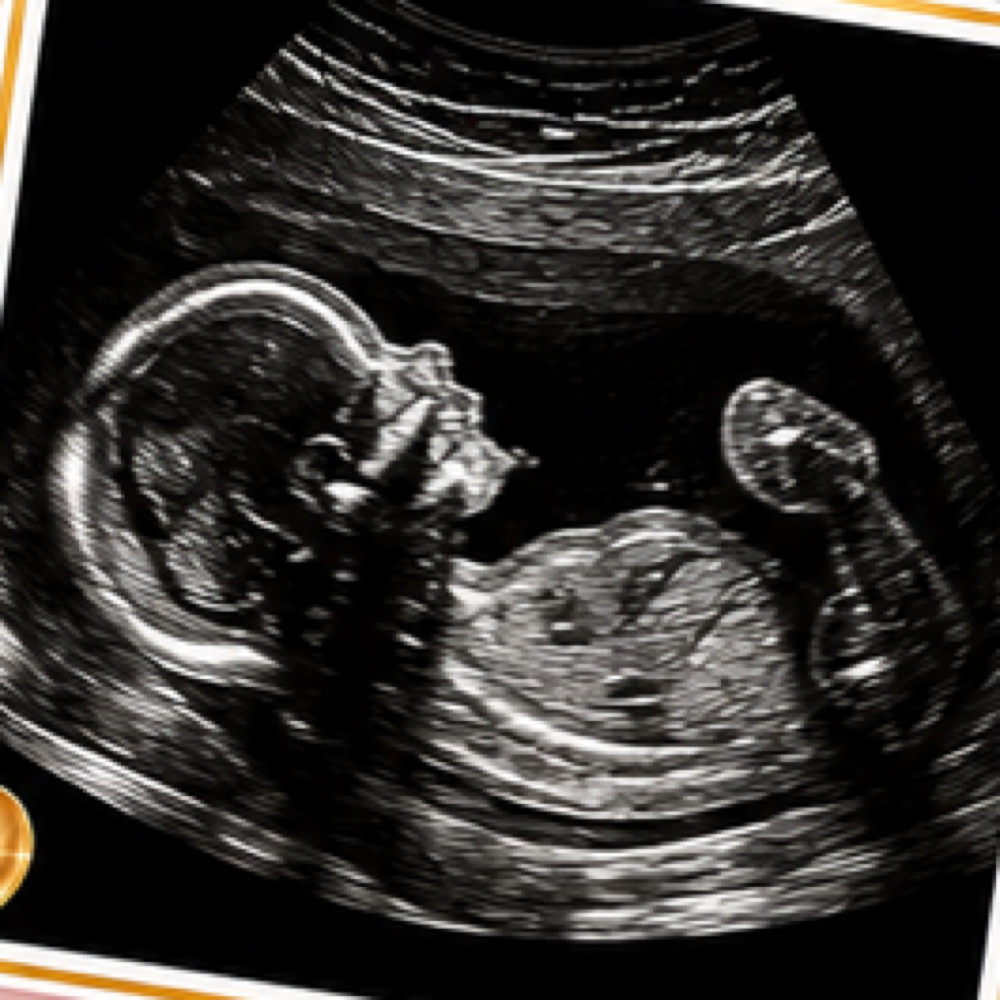 Peek of baby at Babyview 3D4D Imaging in Palmdale, CA