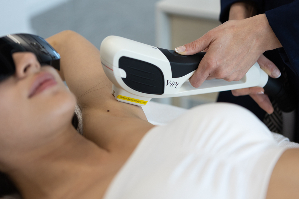 Laser Hair Removal