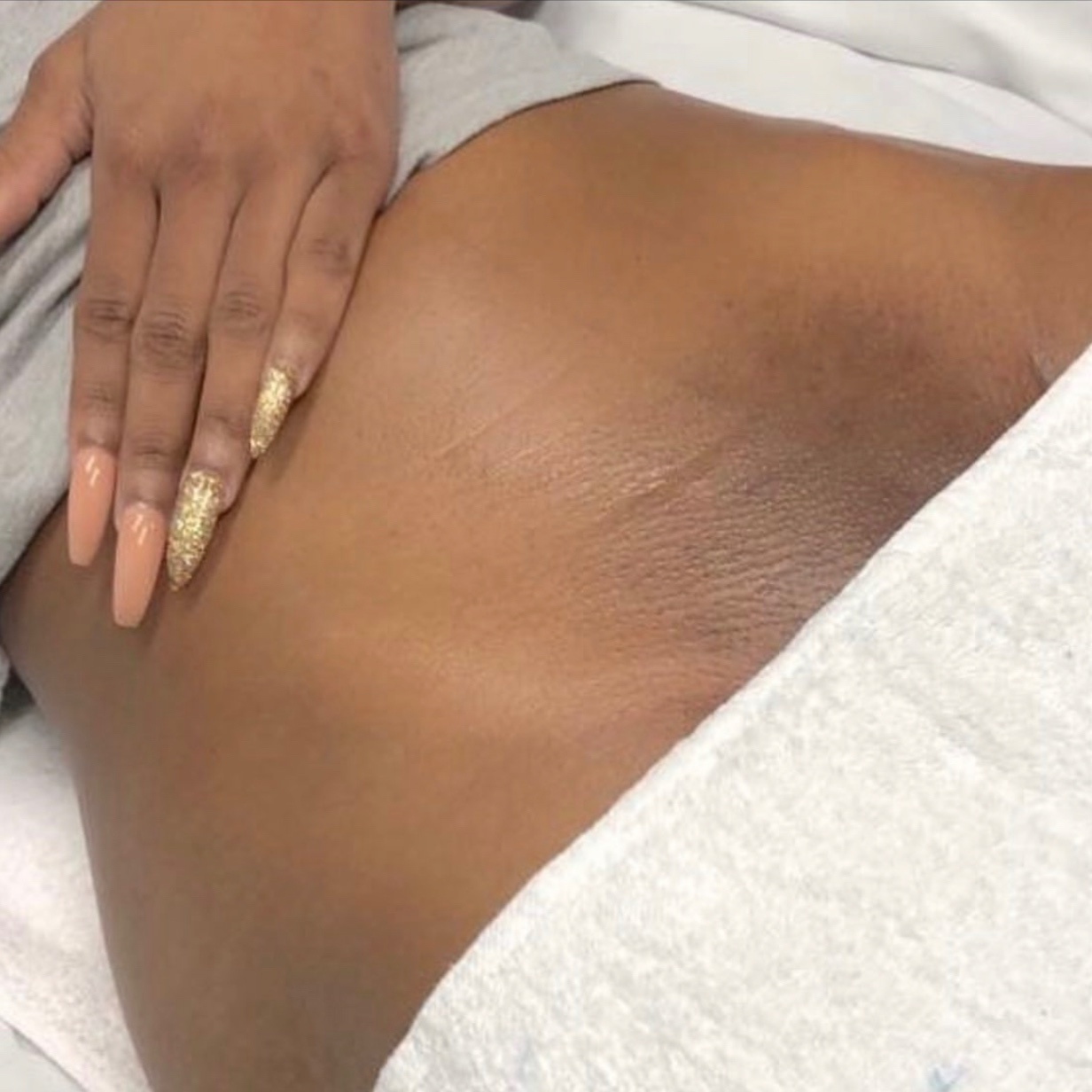 BODY PEEL: SMALL Area at MUSE MAVEN SKINTIQUE AND WELLNESS in Atlanta, GA