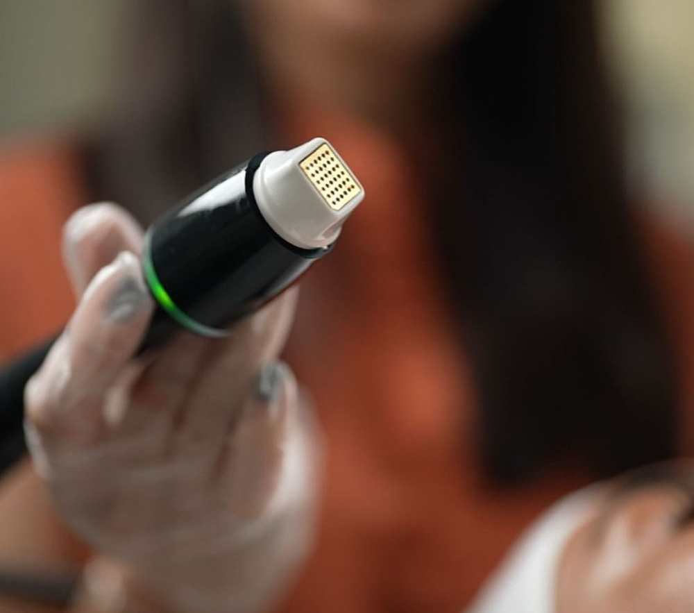 RF Microneedling