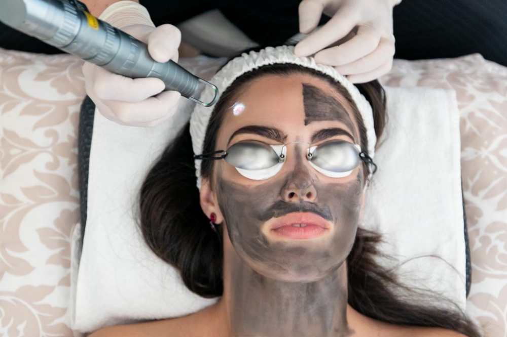 Hollywood Peel
