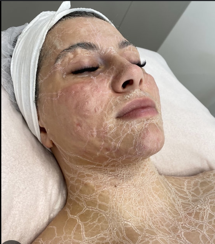 “Zombie” Firming Peptide Facial