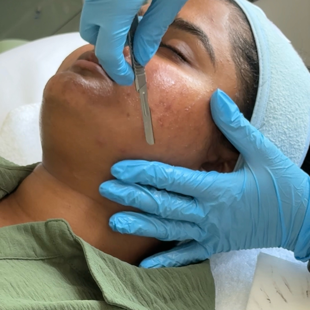 Dermaplane Facial