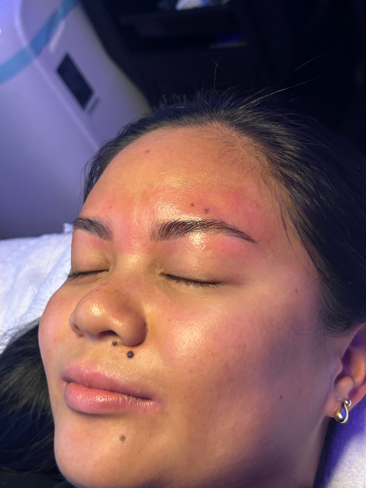 Brow Enhancement at Anela Esthetics in Mountain View, HI