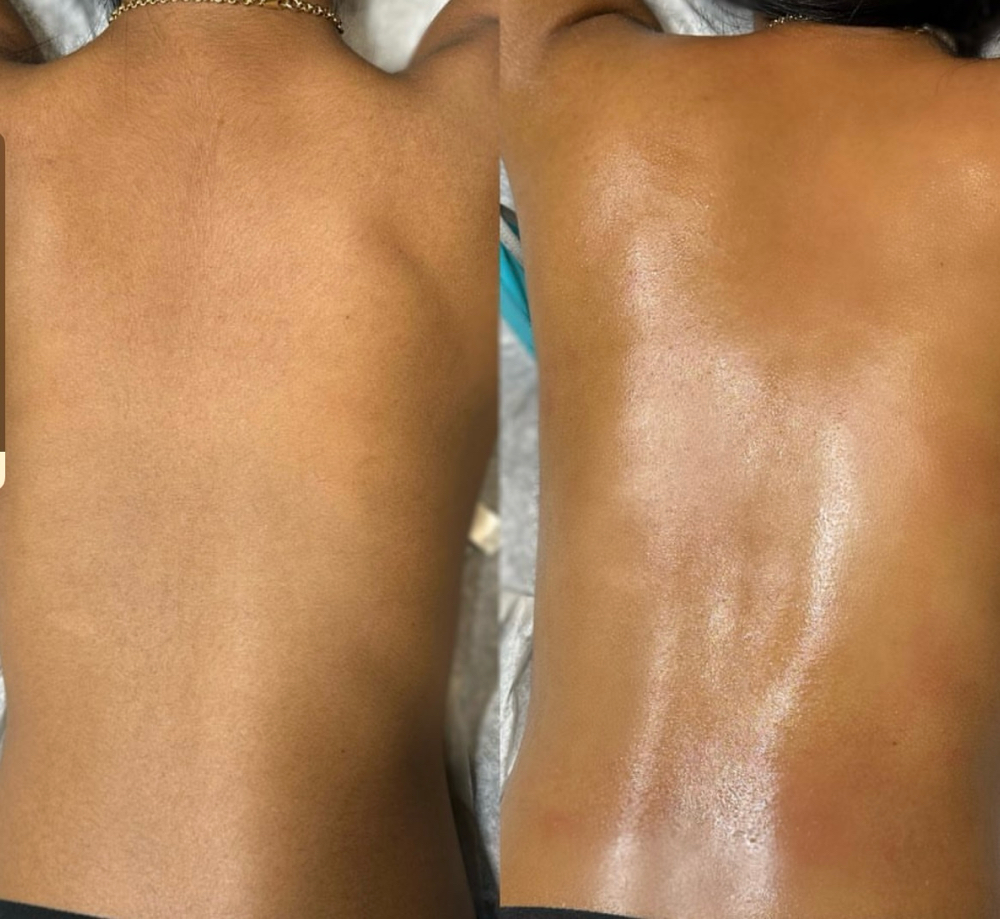 Full Back Wax