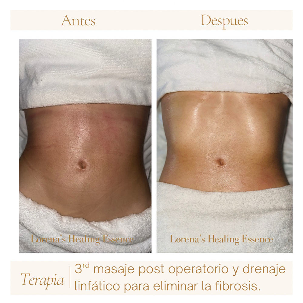 Tratamientos Reductores