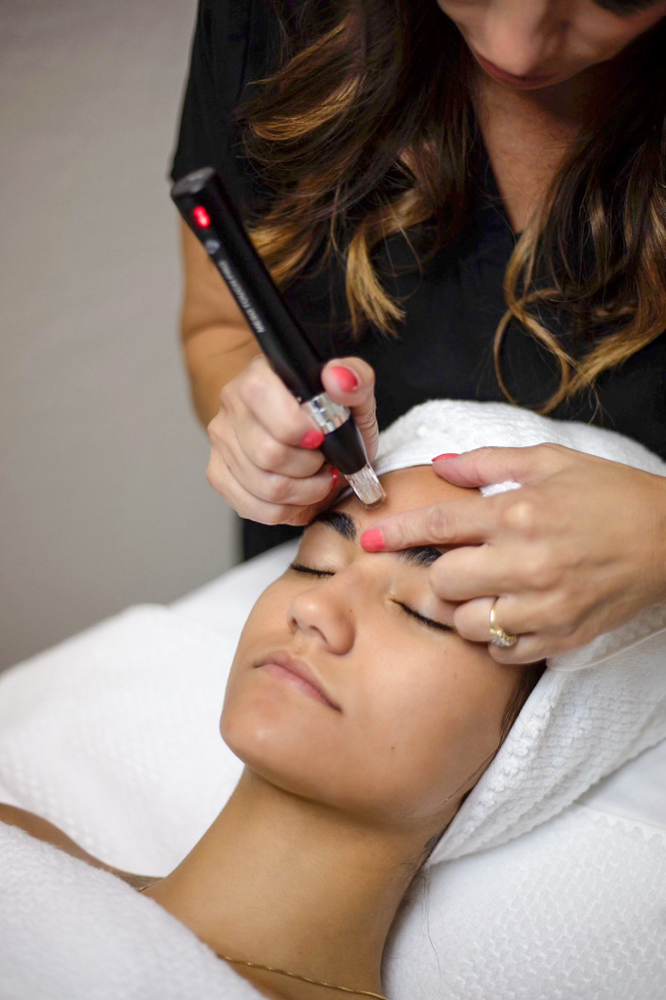 Microneedling Collagen Induction Tx