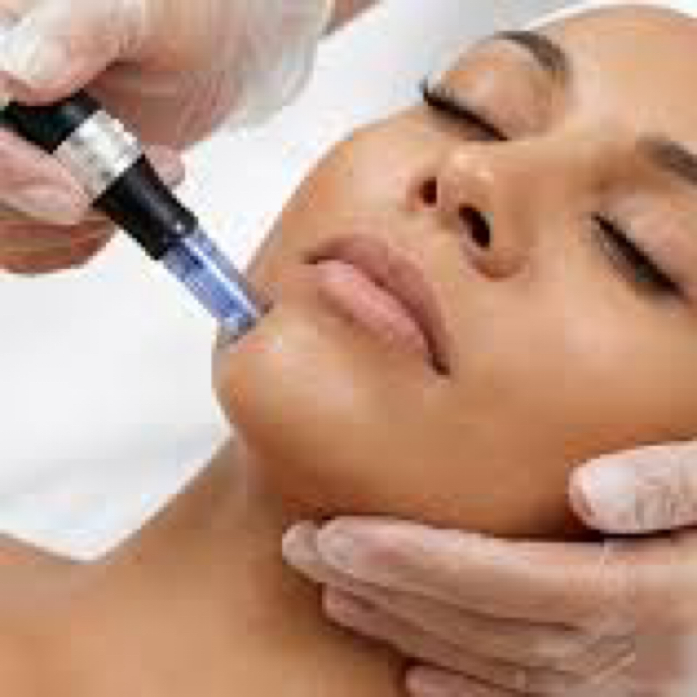 Microneedling Ultimate Regeneration at Mina’s Lovely Beauty Bar in Commack, NY