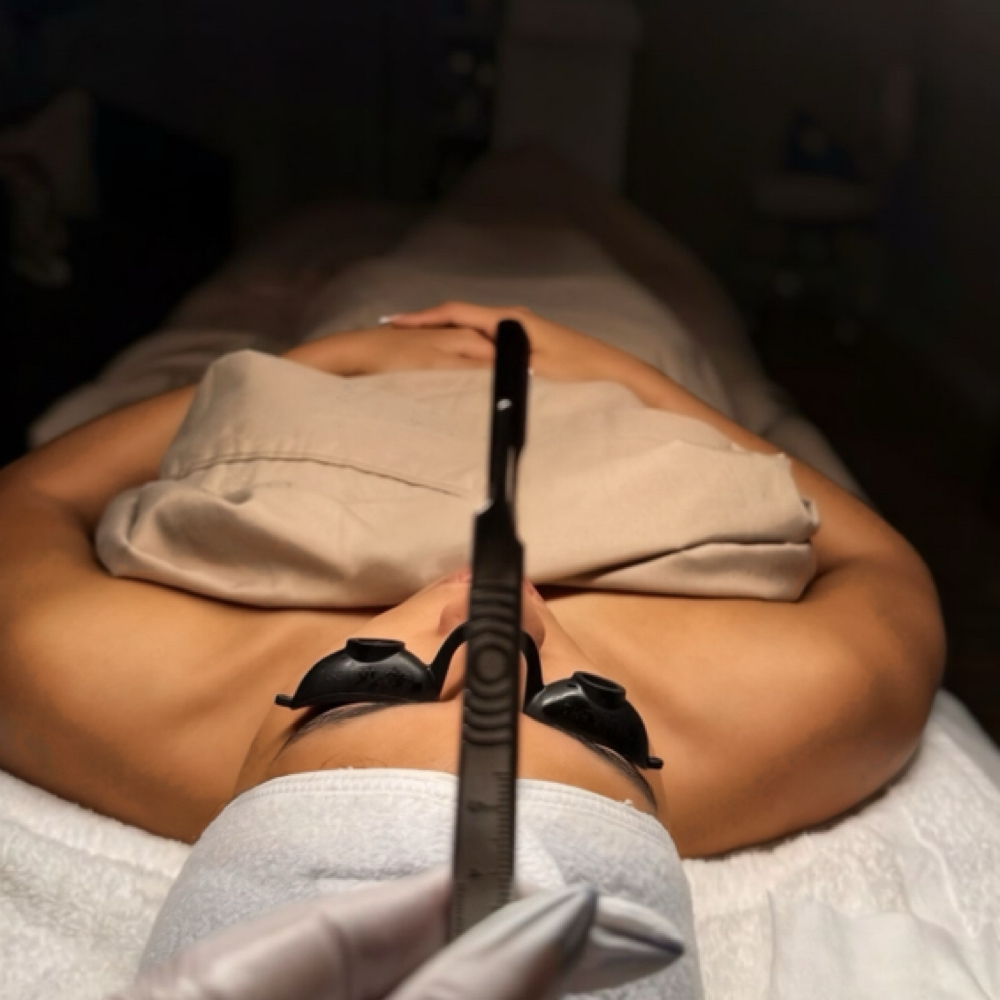 Dermaplane + Brightening Hydration at Uncommon Esthetics in Rancho Cucamonga, CA