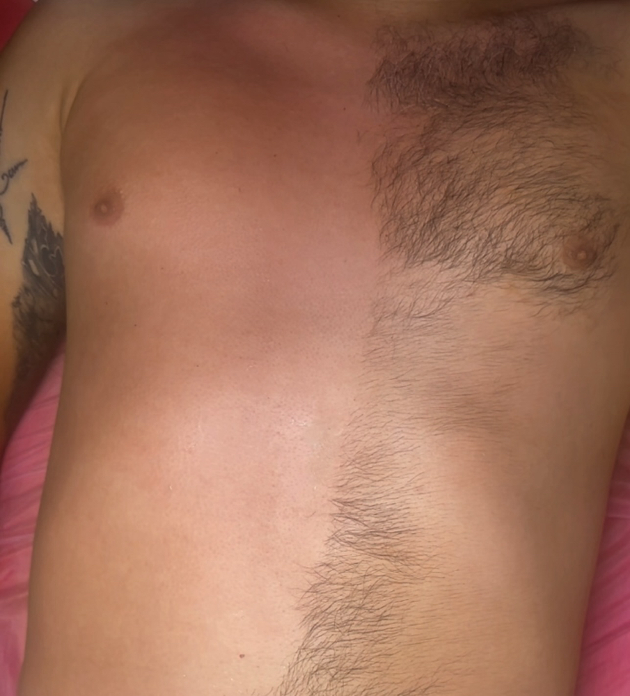 Chest