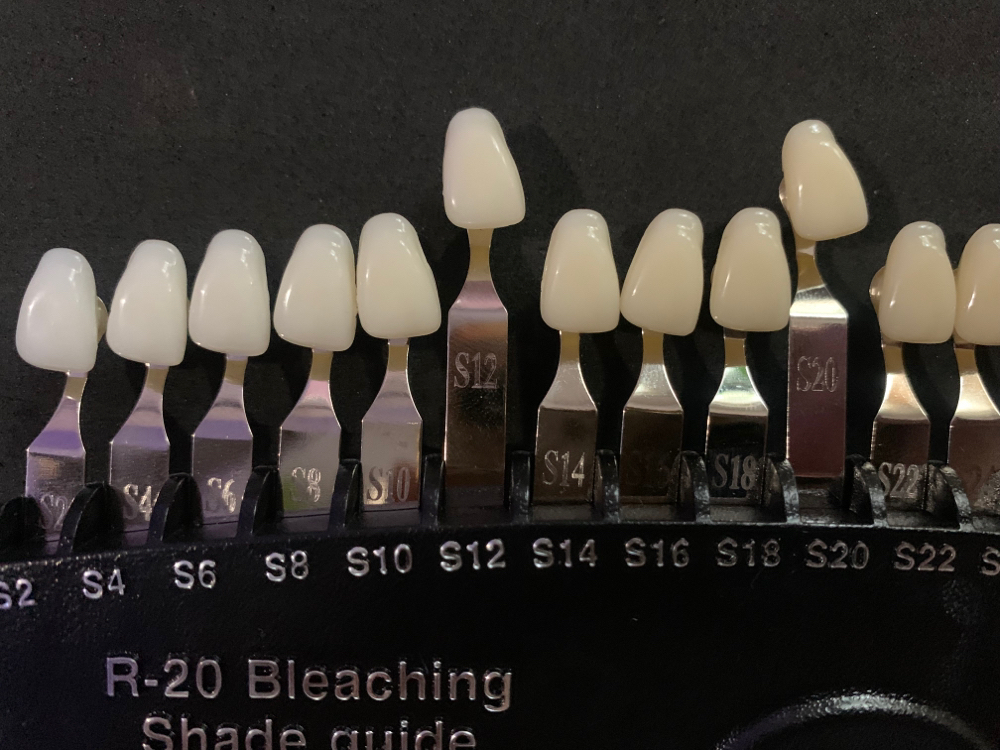 17% Gel- Teeth Whitening