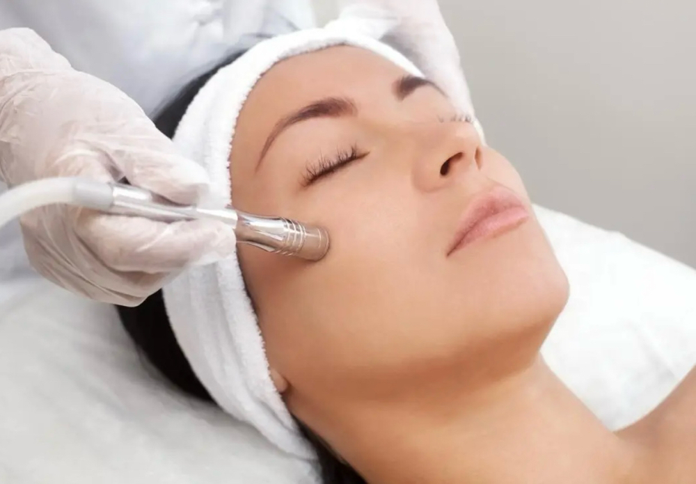 Microdermabrasion