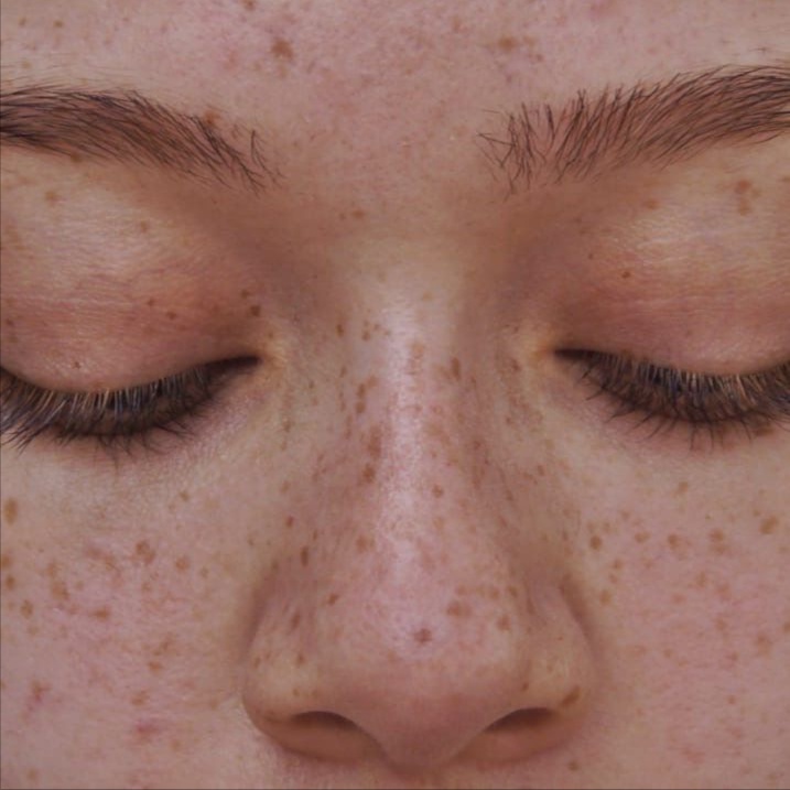 Freckles at Mayra Benitez in Glendale, CA