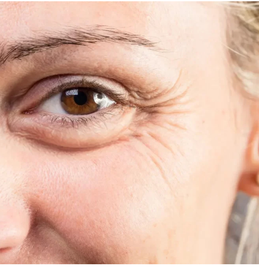 TLI | WRINKLE REPAIR 8 Tx