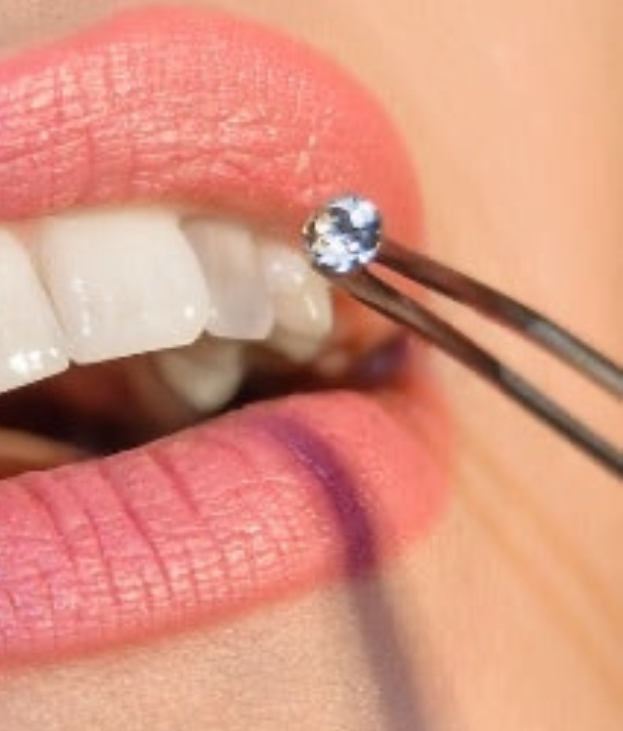 Gem Removal