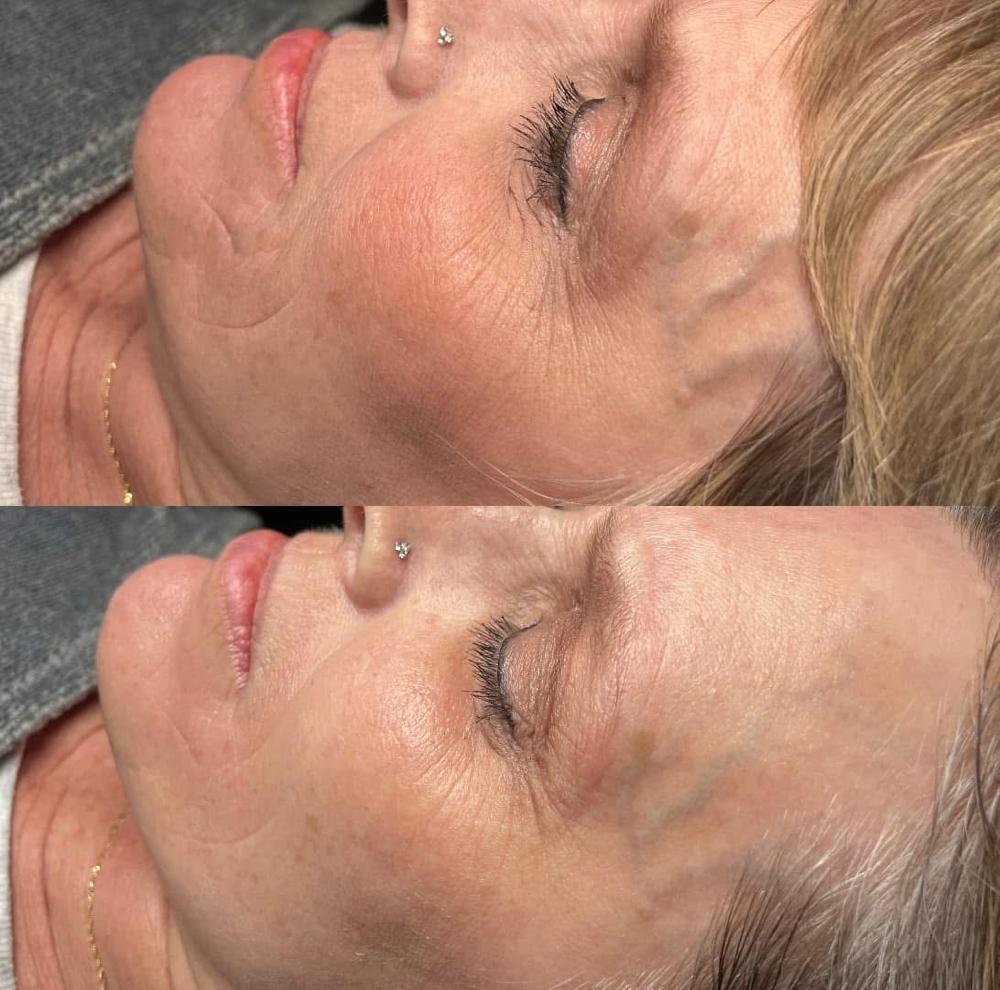 Signature Facial 90 Minutes