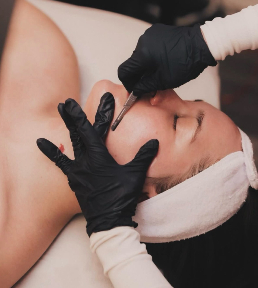 Dermaplaning Treatment at Allure By Ayana in Memphis, TN
