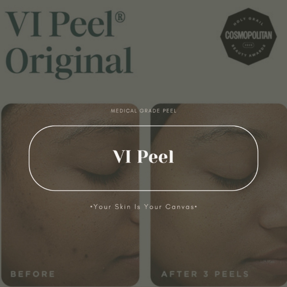 VI PEEL at Face Palette Aesthetics in Franklin, WI