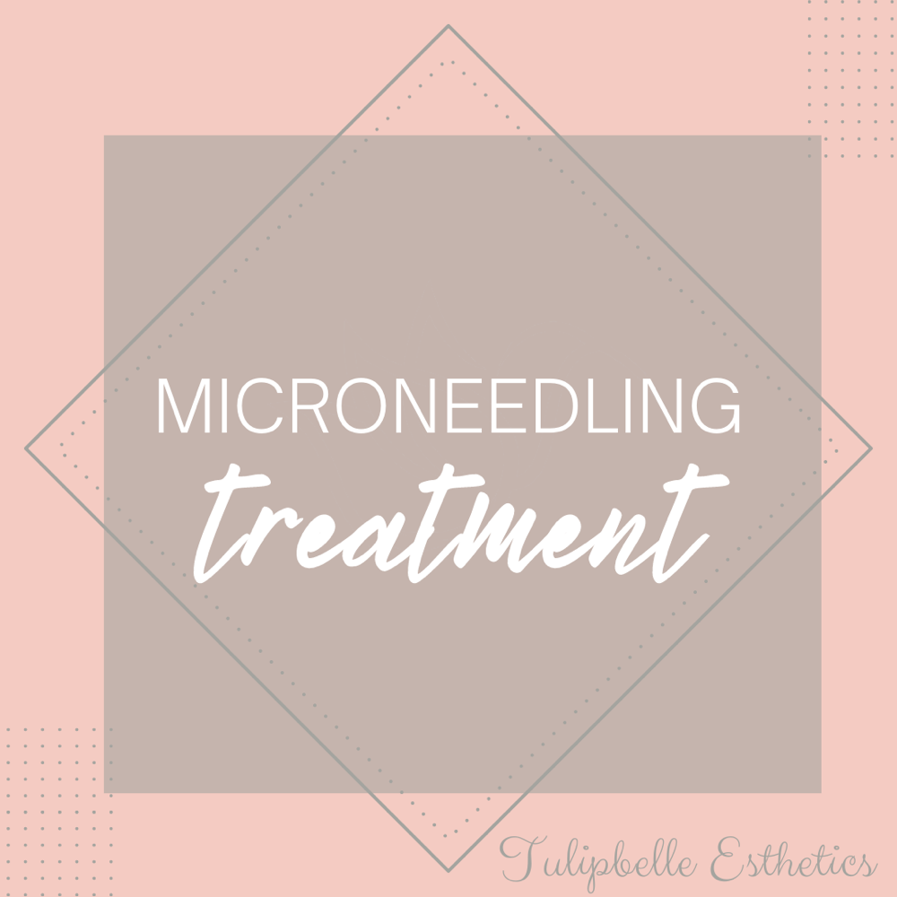 Microneedling Treatment