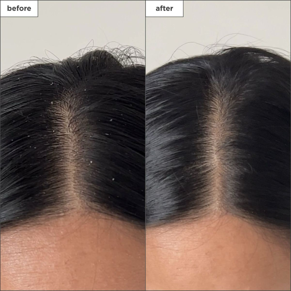Scalp Clarifying & Exfoliation at The Gema Beauty in Round Rock, TX