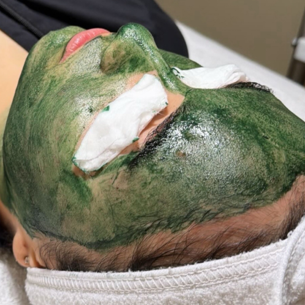 Customized Peel at Blu Topaz Esthetics in Aurora, IL