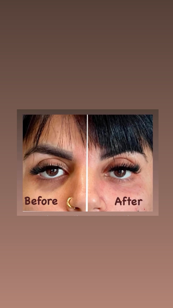 Under Eyes Correction/skinvive