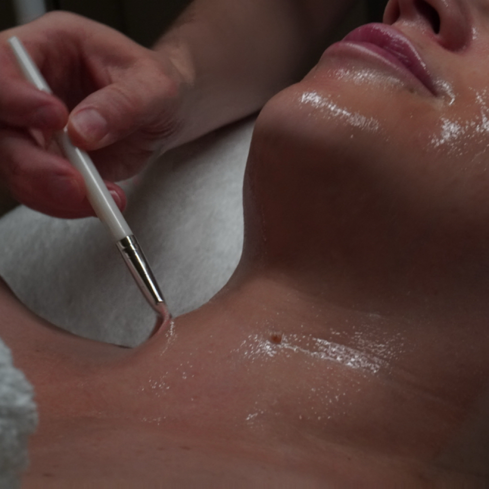 Deluxe Dermaplane Facials at Complexion Therapy in Kennewick, WA