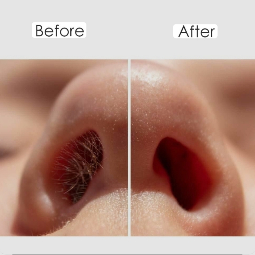 Nose Hair Removal at Desert Glow Esthetics in EL Paso, TX