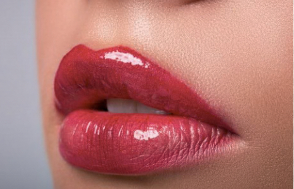 Dermal Filler - Lips
