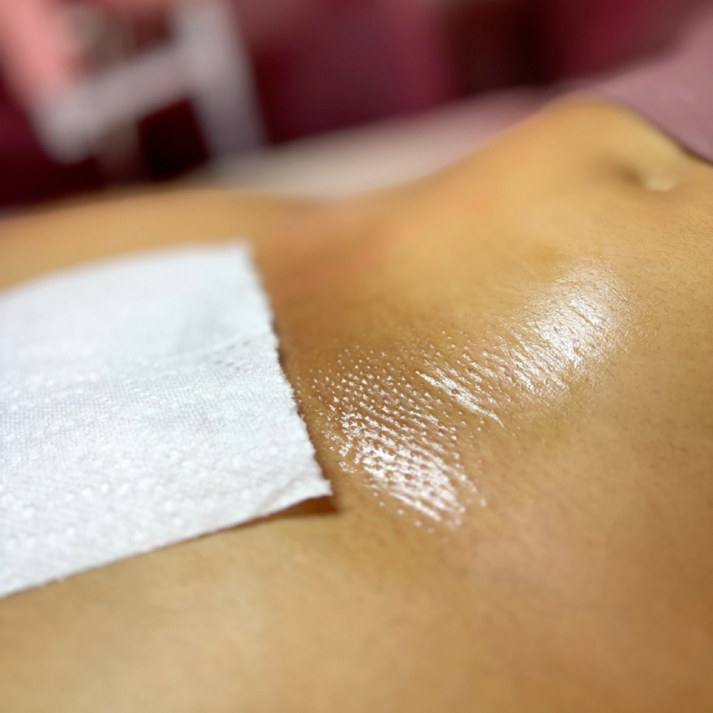 Brazilian + Extractions at Too Flawless Esthetics in Memphis, TN