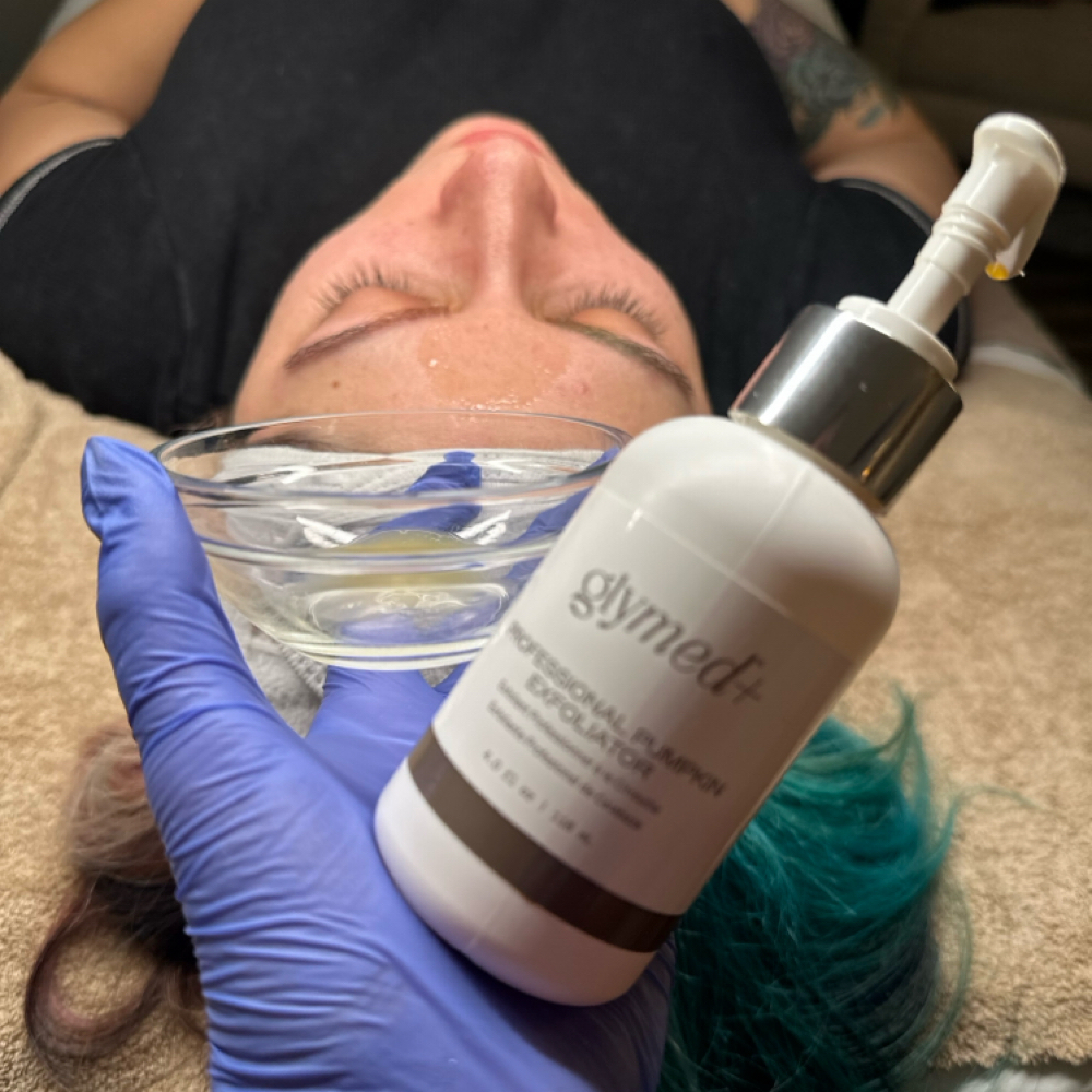 Chemical Peels at SNT AESTHETICS in North Richland Hills, TX