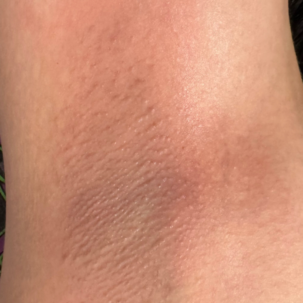 Underarm Wax at Crystal Clear Skin by Madison in Sherman, TX