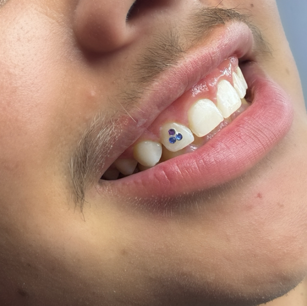 💎 𝟒–𝟔 𝐆𝐞𝐦𝐬 at Alejos Aesthetics in Cleveland, TX