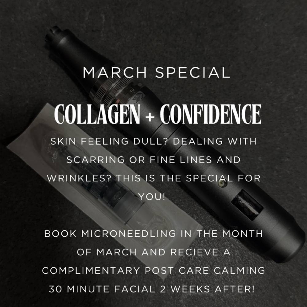 March Microneedling Special at Madsesthetics LLC in Litchfield Park, AZ