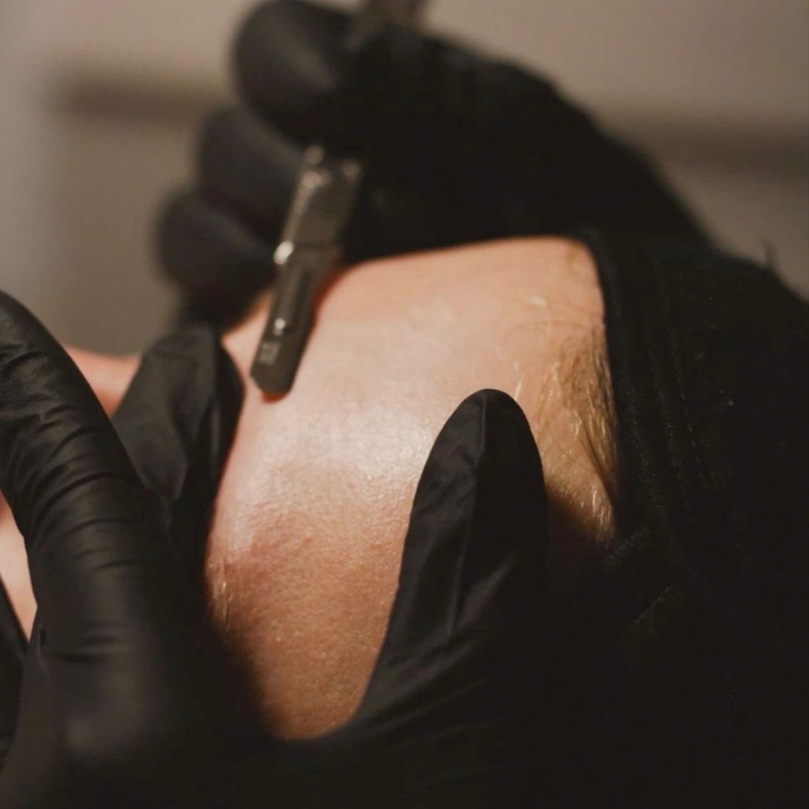Dermaplane Add-On at Cove Aesthetics in Lexington, VA