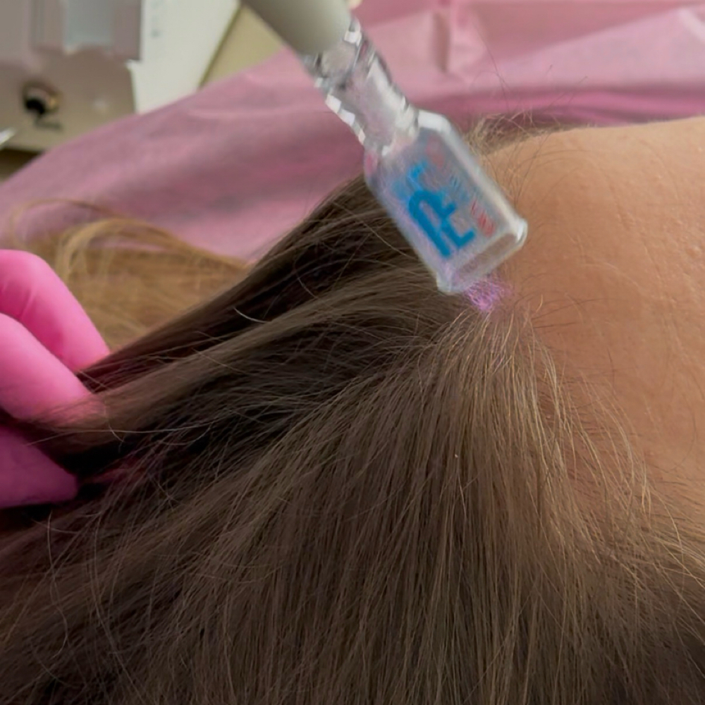 HAIR RESTORATION at Beauty and Brows in Queens, NY