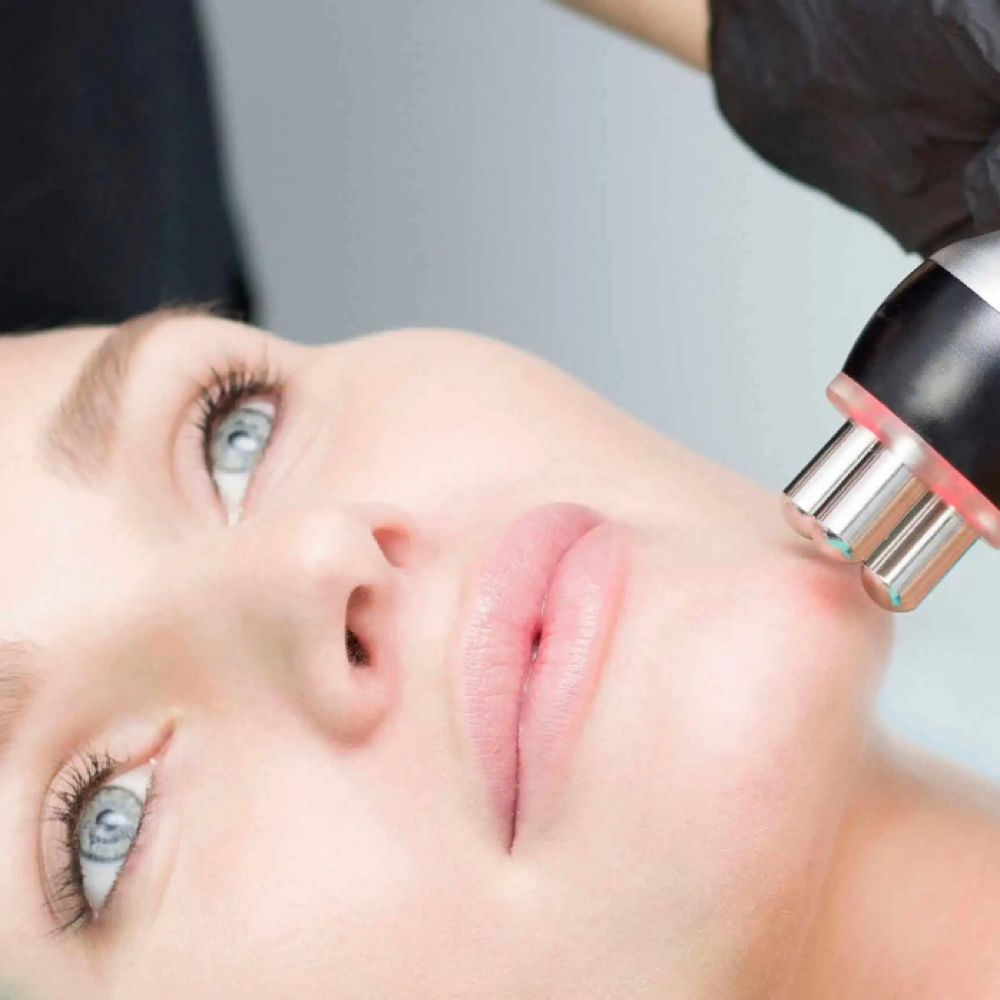 Double Chin Reduction (RF) at WaxLand & BodySculpting in Los Angeles, CA