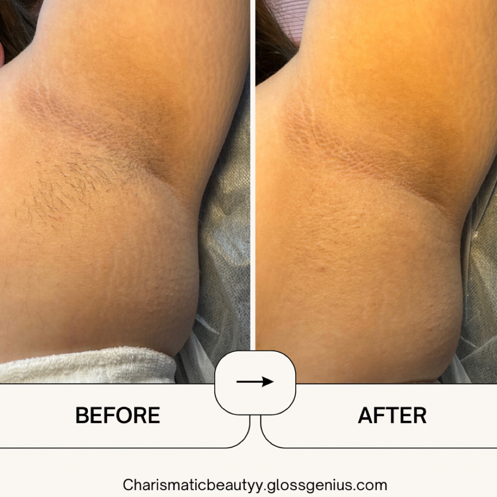 Underarm at Charismatic Beauty in Apple Valley, CA