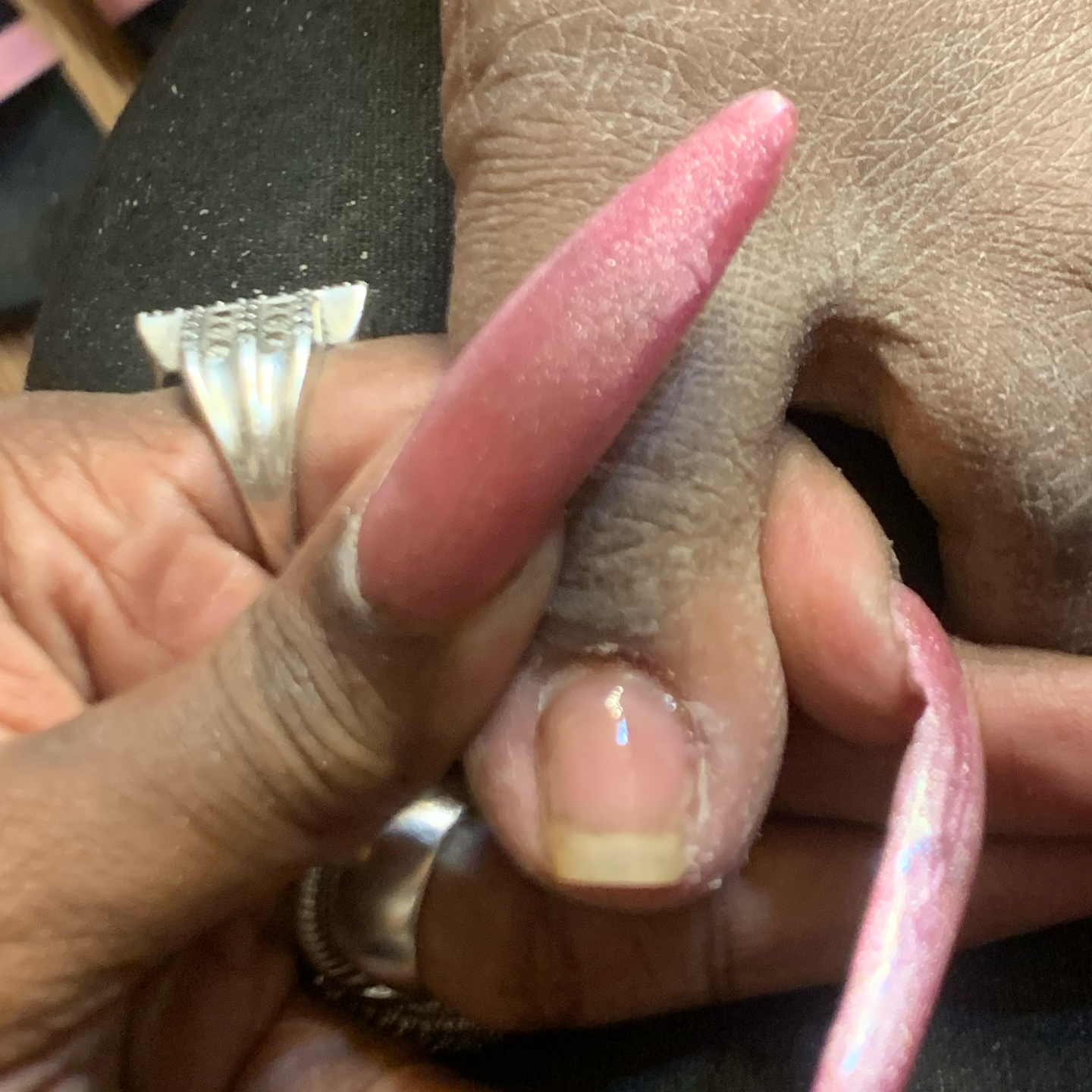 Nail Repair Service