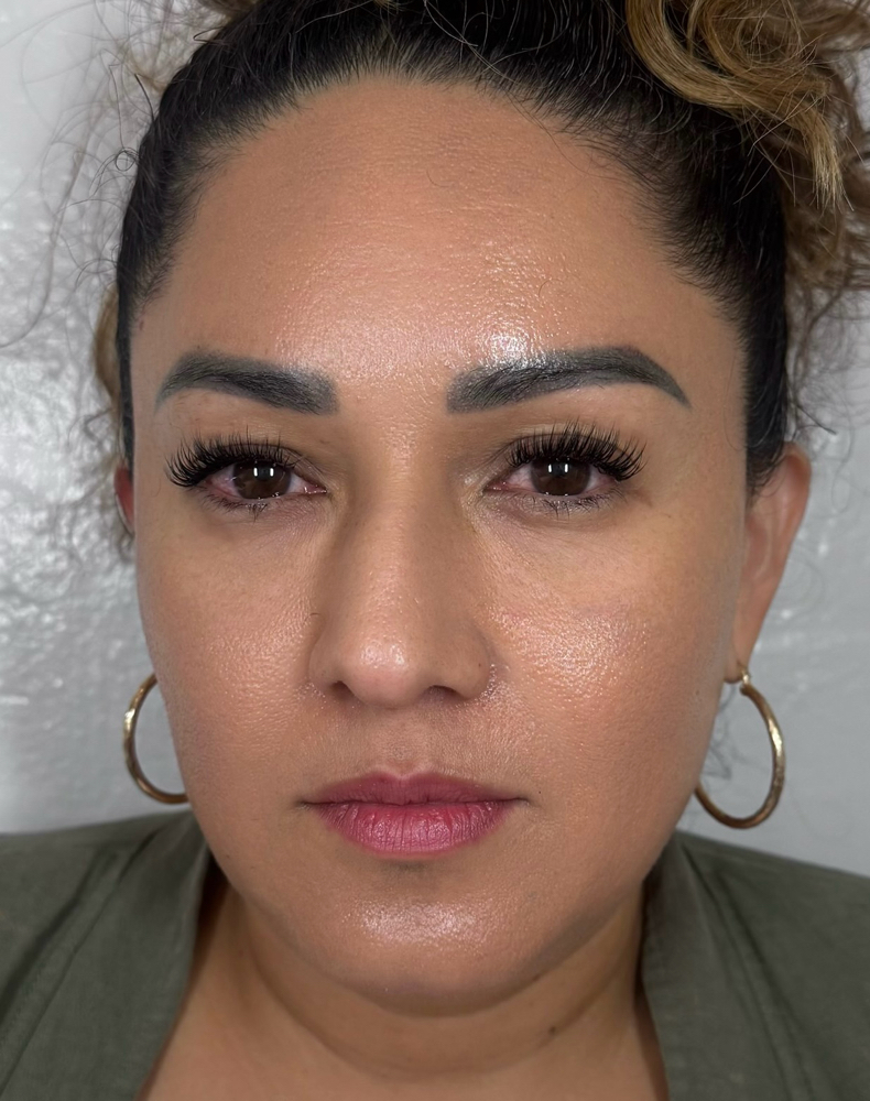 Hybrid Fill
