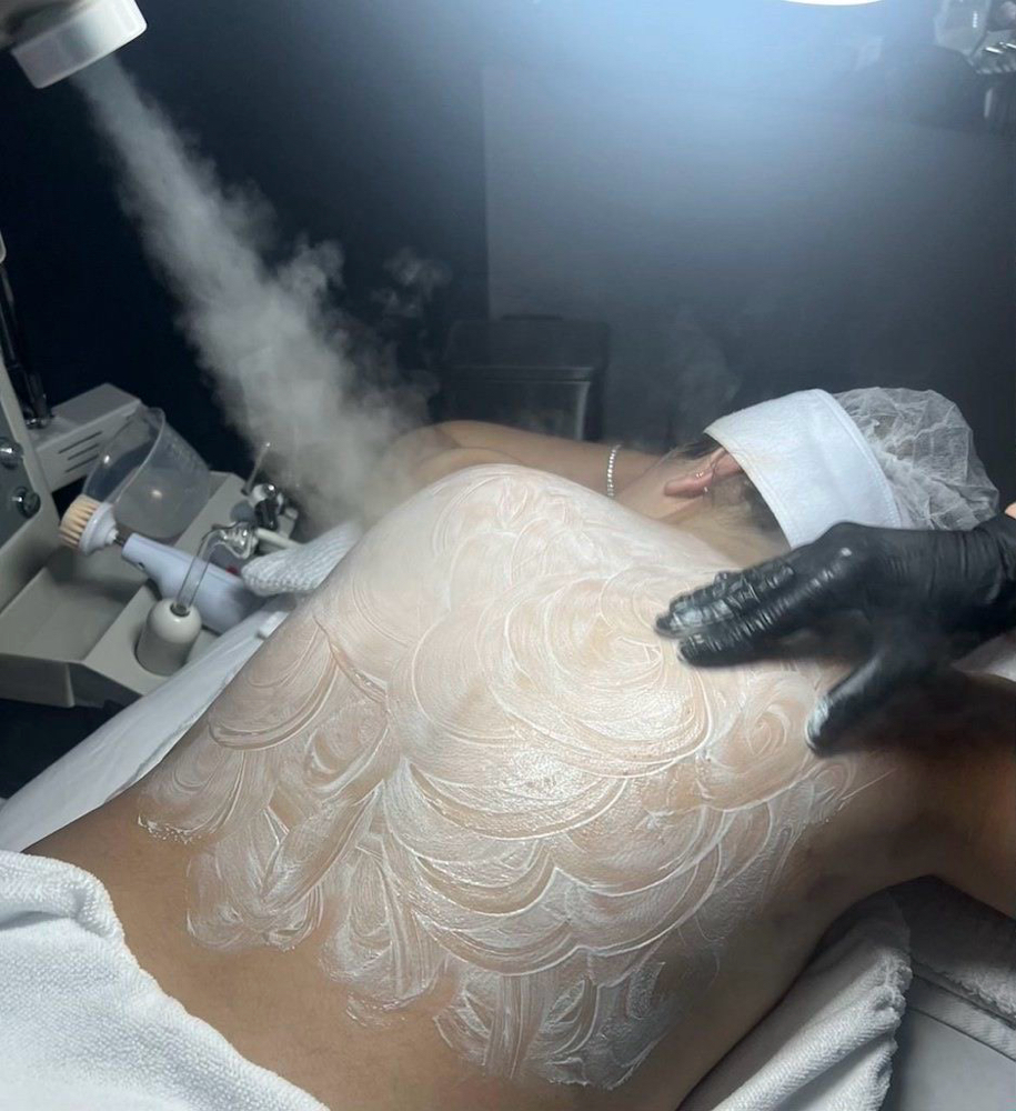 Back Facial at Radiant Glow Esthetics in Corpus Christi, TX