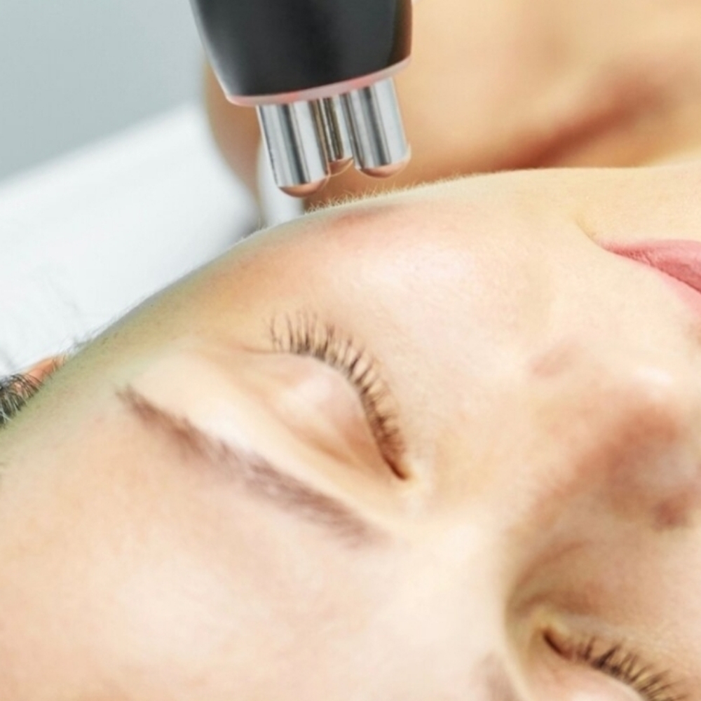 RF Facial & Neck at Viva la Contour in Woodbridge, NJ