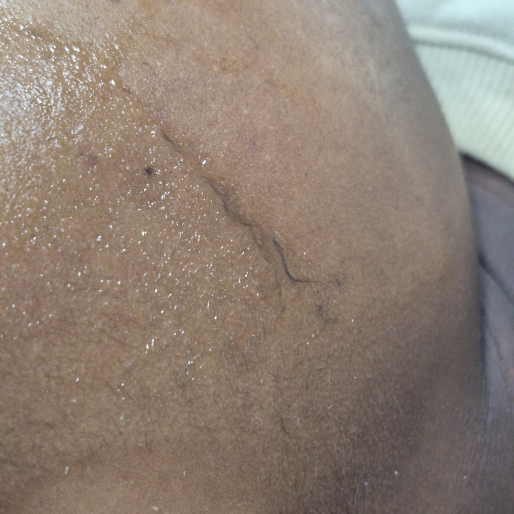 Custom Dermaplaning Facial at Nevaeh Beauty & Brows in Dayton, OH