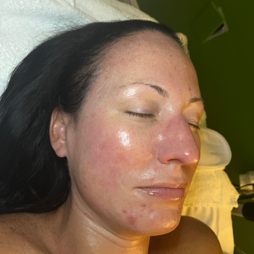 OxyGlow Facial at Genesis Health and Beauty Bar in Daphne, AL