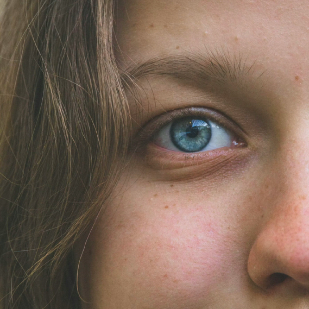 Cheek Filler (1 SYRINGE) Juvederm at Bloom Aesthetics LLC in El Paso, TX