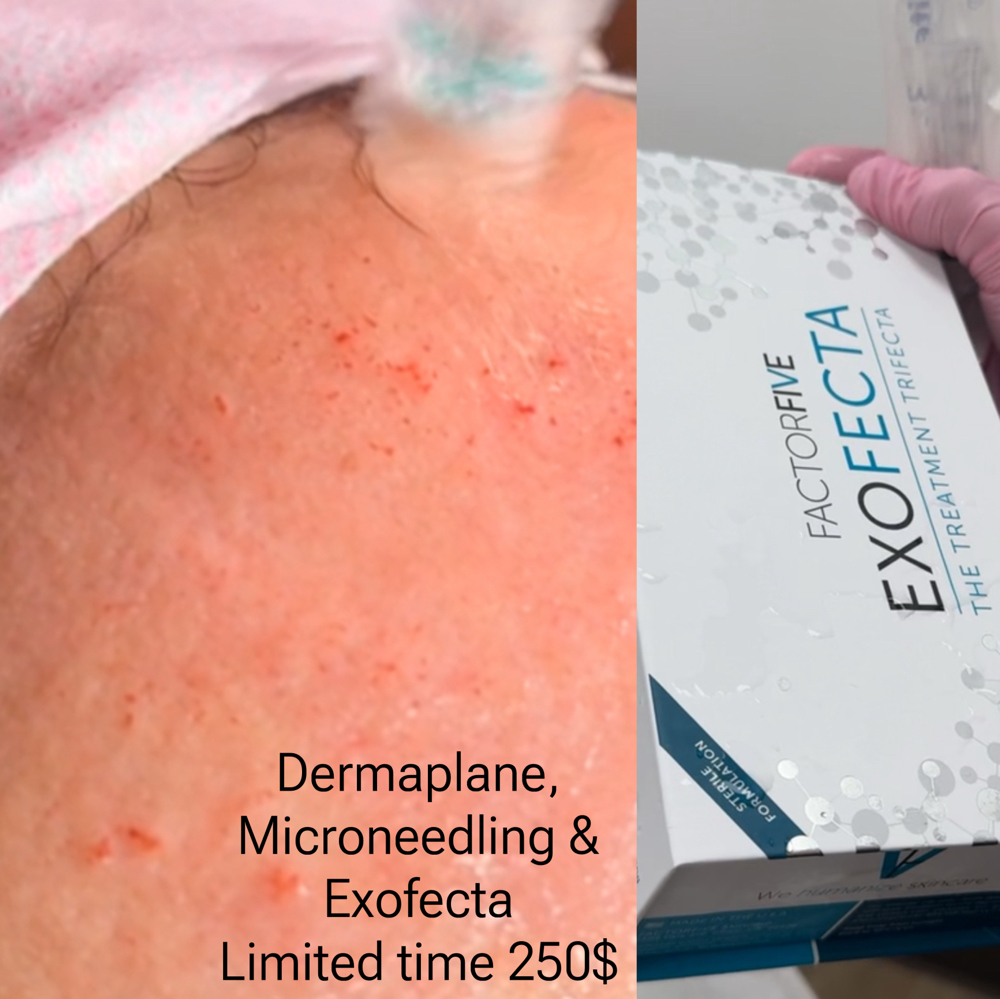 Trial - Derma, Micro & Exofecta